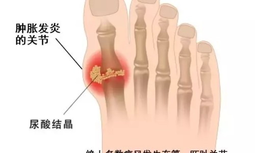 糖尿病人必须戒烟吗-糖尿病人戒烟怎么办网- 糖尿病戒烟后身体会出现的各种变化知识,分享糖尿病人戒烟后饮食要注意什么